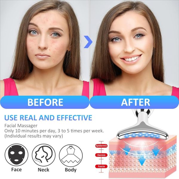 Es-1081 Massager Intense Pulsed Light Wrinkles Reducing